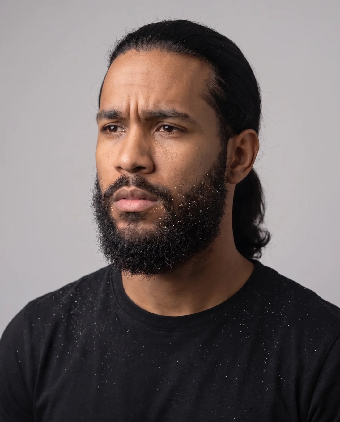 Beard Dandruff: What Causes It and How to Get Rid of It